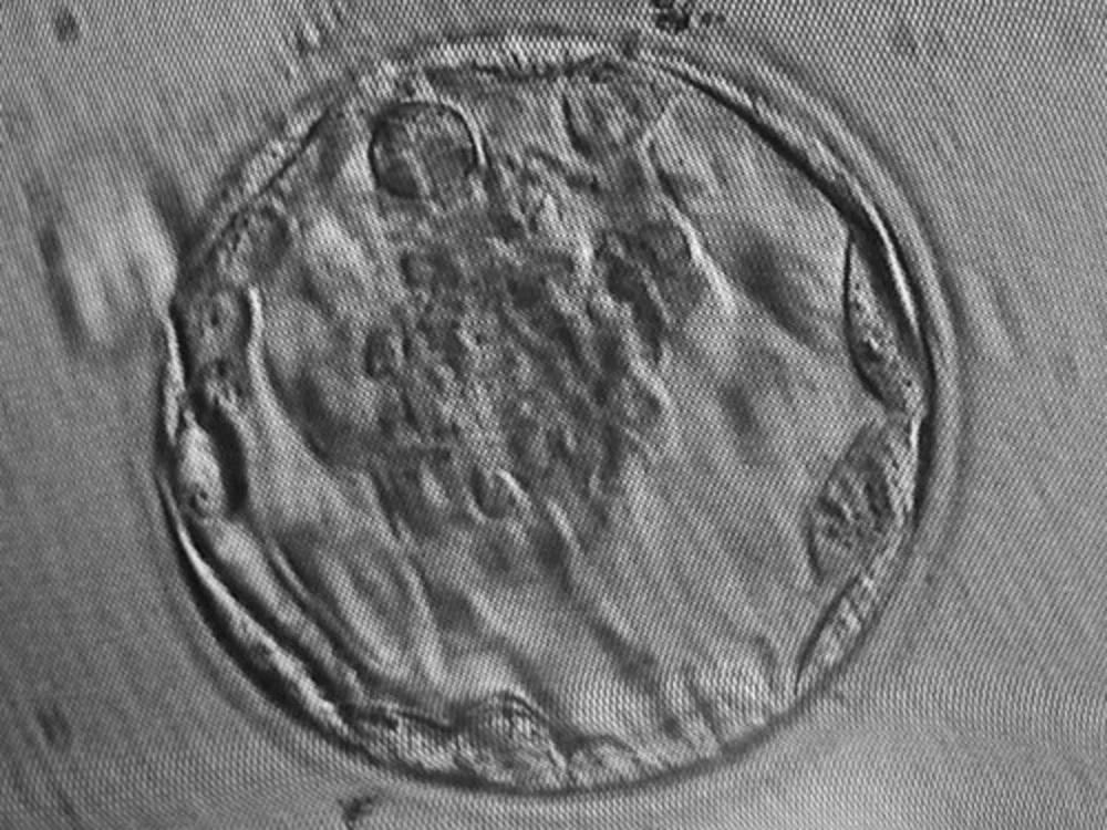 Microscopy photograph of a blastocyst used for morphological assessment