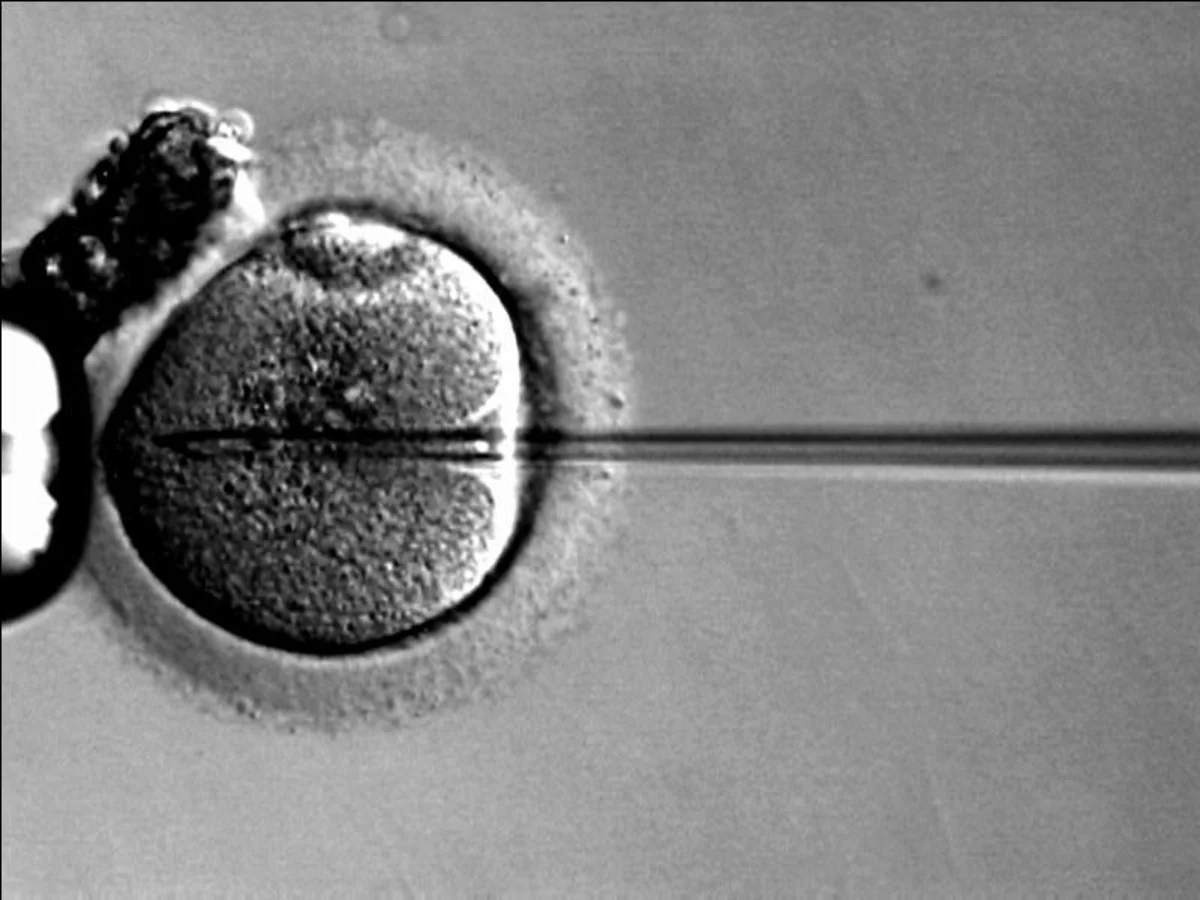 Micromanipulation of an oocyte viewed through an inverted laboratory microscope